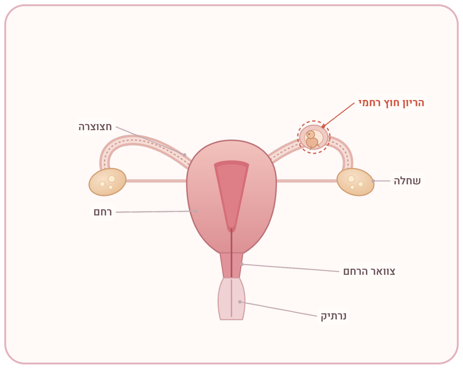 איך מזהים הריון חוץ רחמי